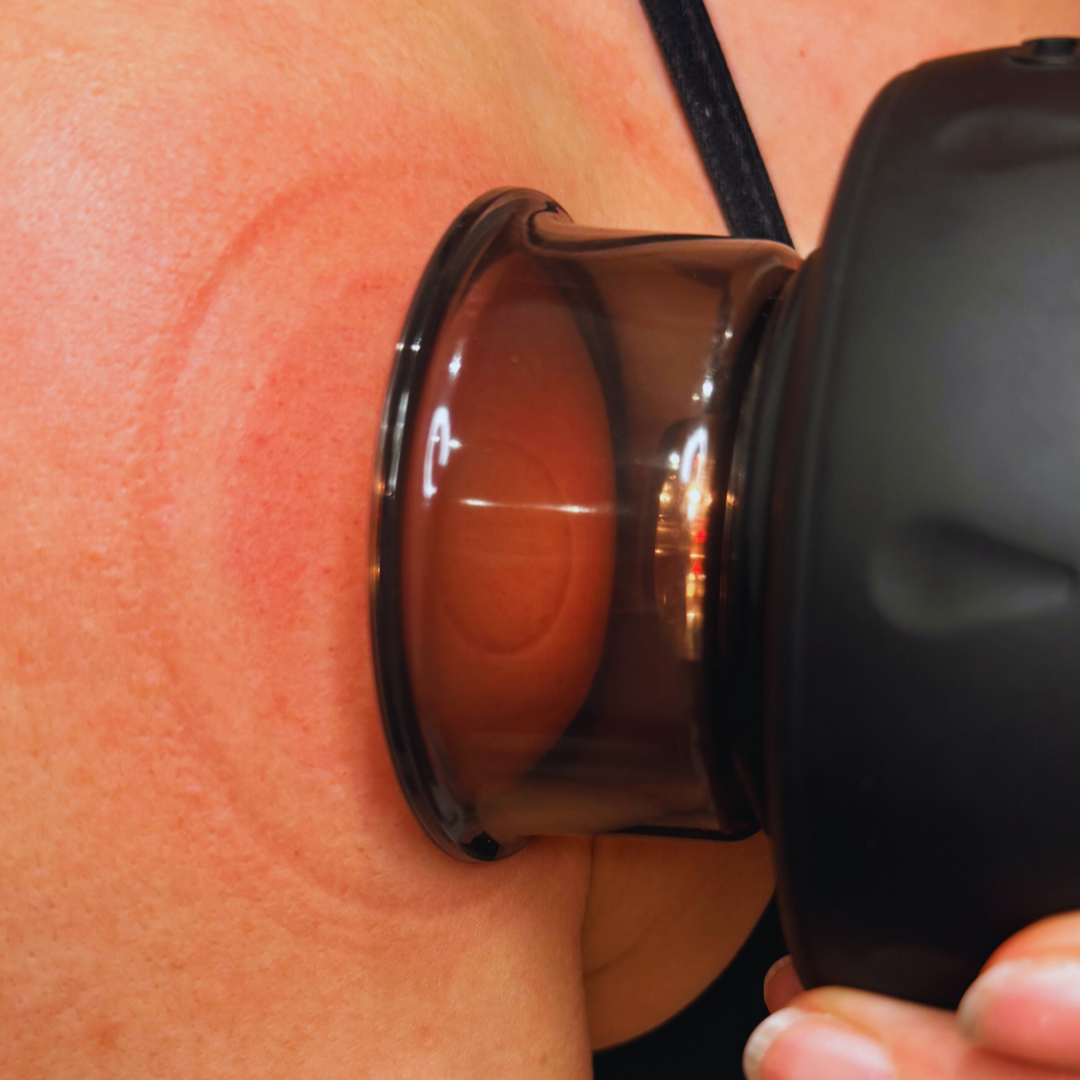 CupFlex Pro 2.0 Infraröd koppning